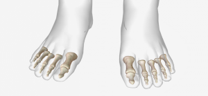 Foot phalanges
