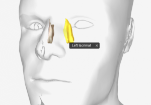 Lacrimal bone