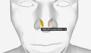 Inferior Nasal conchae