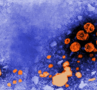 HEPATITIS