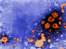 HEPATITIS