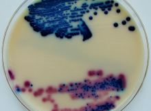 Urine_cultured_on_Oxoid_Brilliance_UTI_Agar_plate