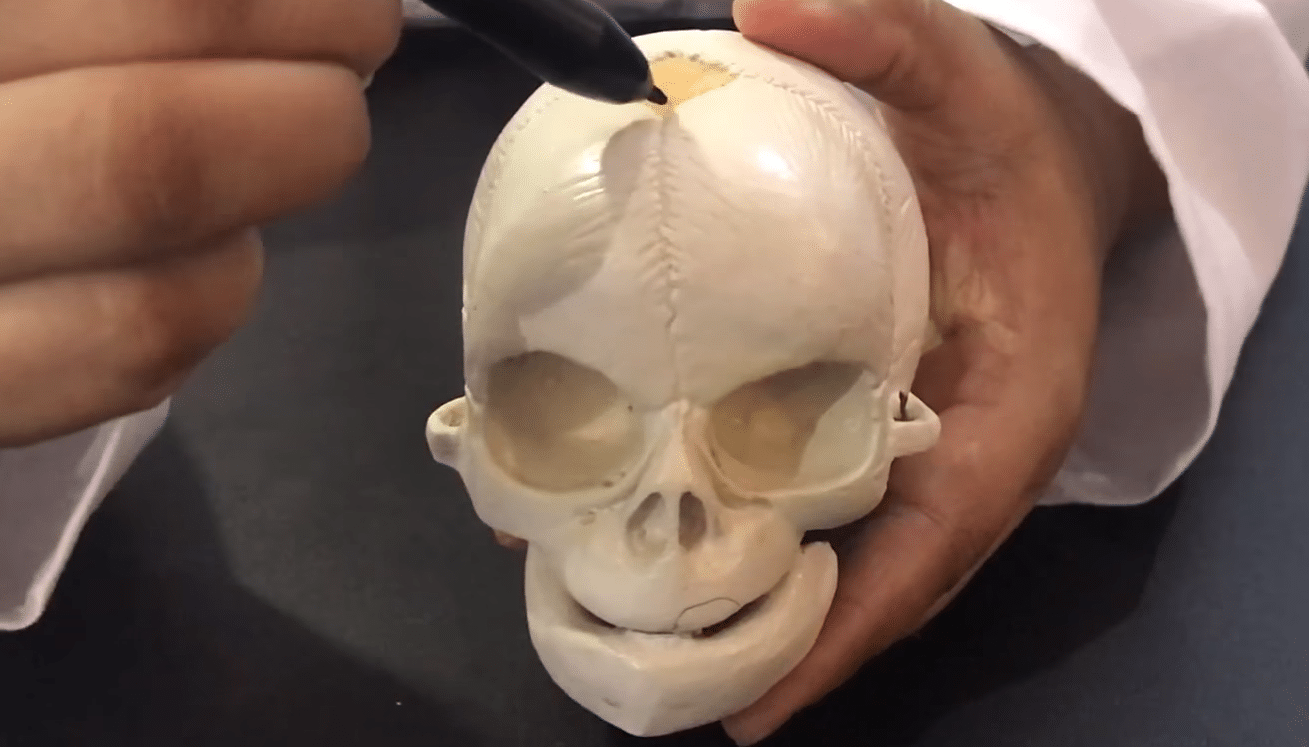 Fetal-Skull