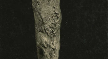 OSTEOMYELITIS
