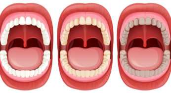 Mouth